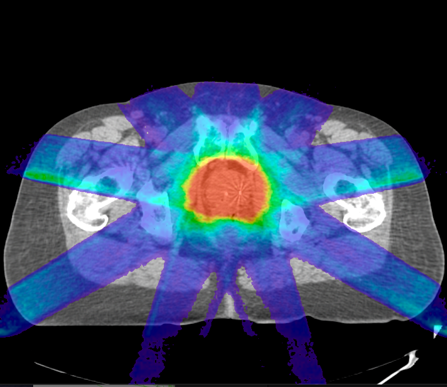 Clinical dose visualization