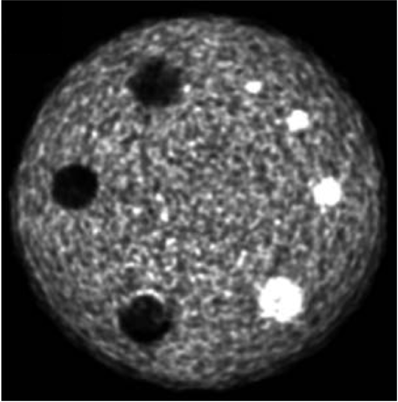 Medical imaging workflow